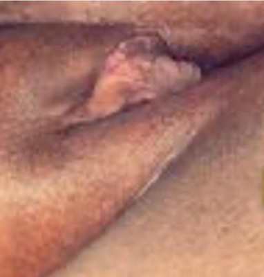 DICKTAMER🥰❤HeadSpecial $70condom